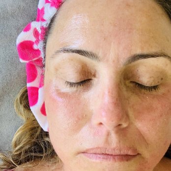 Lori Hart About Face and Beyond - Skin Care Near Me - Los Angeles, California