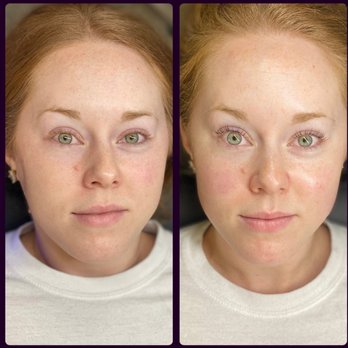 Rawwbeauty - Before and after services - Tattoo Removal Near Me - Homewood, Alabama