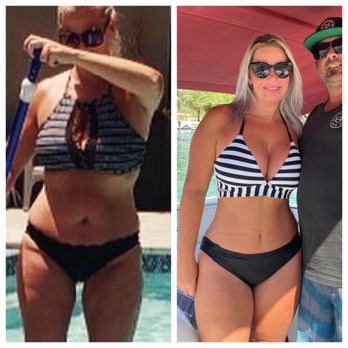 Donald S Mowlds, MD - Before and after - Plastic Surgeons Near Me - Newport Beach, California Donald S Mowlds, MD - Before and after - Plastic Surgeons Near Me - Newport Beach, California