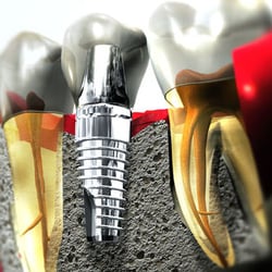 Dental Professionals of Algonquin
