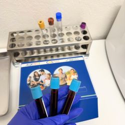 Lay Lab - Alzheimer's disease affects memory, thinking, and quality of life, but early testing can make a difference.
