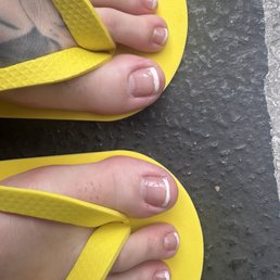 Cut up toes and the uneven botched French tip Cut up toes and the uneven botched French tip