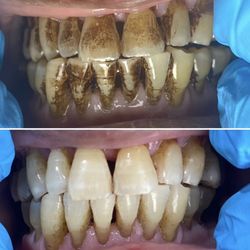 Smiles Cafe Dentistry