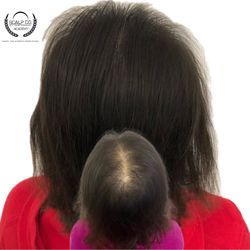 Scalp Co.