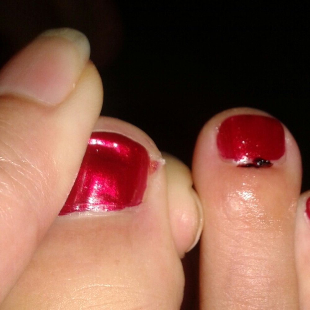 Smiley Nails - Smiley Nails pedicure. Lady cut me on two toes and said it's okay b/c no blood! - Nail Salons Near Me - Honolulu, Hawaii Smiley Nails - Smiley Nails pedicure. Lady cut me on two toes and said it's okay b/c no blood! - Nail Salons Near Me - Honolulu, Hawaii