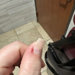 I was cut several times. I was cut several times.
