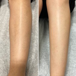 Lower leg wax, before and after.