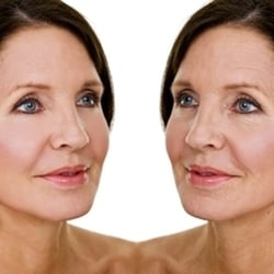 Laserase Medical Skincare Clinic