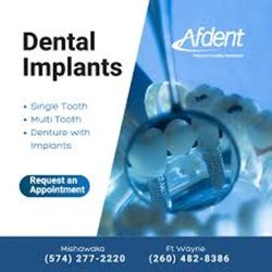 Afdent