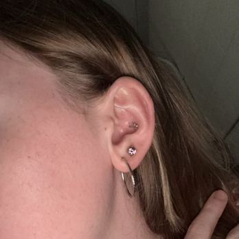 Little John's Tattoo - Double lobe piercing 3 days after operation. - Tattoo Near Me - Greensboro, North Carolina Little John's Tattoo - Double lobe piercing 3 days after operation. - Tattoo Near Me - Greensboro, North Carolina