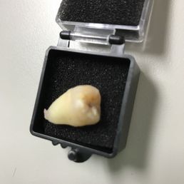 Not the cutest picture. But literally didnt feel this sucker come out.
