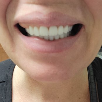 Aspen Dental - Casa Grande, AZ - Oral Surgeons Near Me - Casa Grande, Arizona