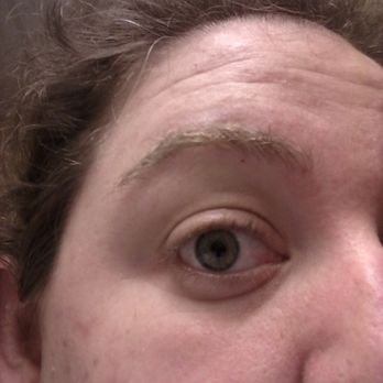 Shova Beauty Salon - May be hard to see but, brow irritation and a nicked spot - scabbed over. - Hair Salons Near Me - Newark, California Shova Beauty Salon - May be hard to see but, brow irritation and a nicked spot - scabbed over. - Hair Salons Near Me - Newark, California
