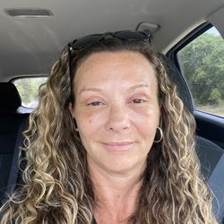 ImageLift - Still healing- 6 days post surgery of upper bleph