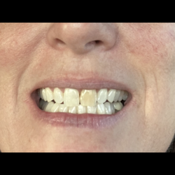 Ryan Duval - Loop 101 Endodontics - Before