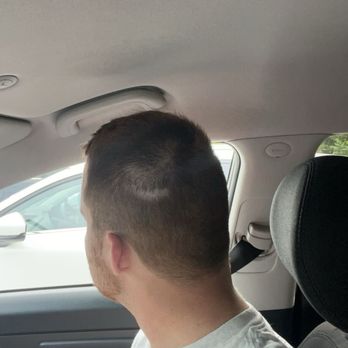Benny's Barber Shop - Bald spot shaved into my head. Accidents happen, but to not say or do a thing about it is what made me upset - Barbers Near Me - Marlborough, Massachusetts Benny's Barber Shop - Bald spot shaved into my head. Accidents happen, but to not say or do a thing about it is what made me upset - Barbers Near Me - Marlborough, Massachusetts