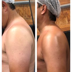 Spray tanning is for men too and can help even out a tan.