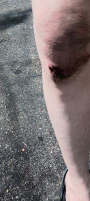 Abbott Northwestern Hospital by null