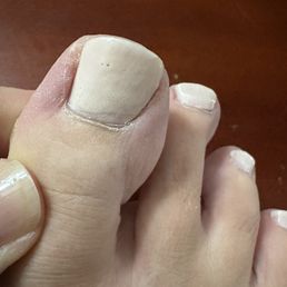 Globbed on polish. Globbed on polish.