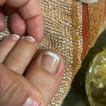 Haute Nails - My poor big toe is swollen, red, and has puss coming out of it. - Nail Salons Near Me - Murrieta, California