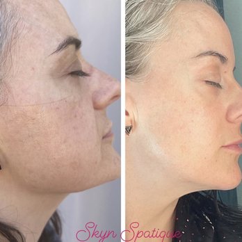 SKYN Spatique Esthetics - Skin Care Near Me SKYN Spatique Esthetics - Skin Care Near Me