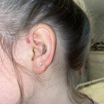 Houston Heights Tattoo - After removal - Tattoo Near Me - Houston, Texas
