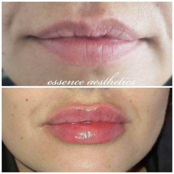 Essence Aesthetics - Medical Spas Near Me - Windsor, Colorado Essence Aesthetics - Medical Spas Near Me - Windsor, Colorado
