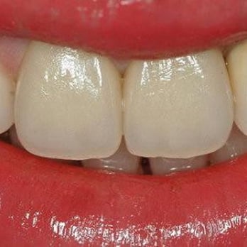 Joyce Xia, DDS - Best dentist - Dentists Near Me - Sterling, Virginia Joyce Xia, DDS - Best dentist - Dentists Near Me - Sterling, Virginia