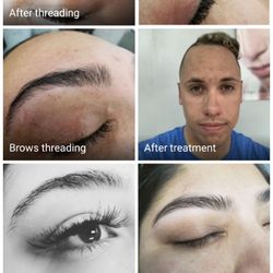 Brows by Manisha - Threading/acne treatment