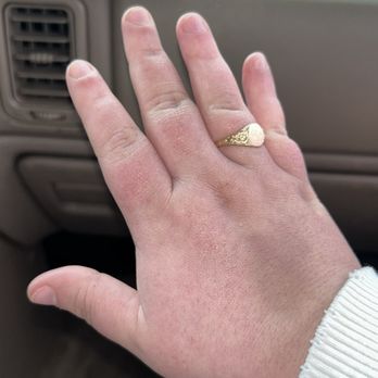 Glo Tanning - The hand that got tanned - Tanning Near Me - Chattanooga, Tennessee Glo Tanning - The hand that got tanned - Tanning Near Me - Chattanooga, Tennessee