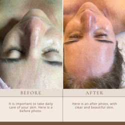 Glow to Go Durango - Customized facial