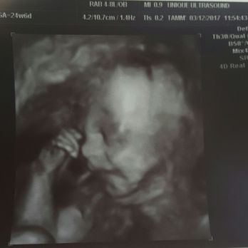 Unique Ultrasound - Diagnostic Imaging Near Me - Temecula, California Unique Ultrasound - Diagnostic Imaging Near Me - Temecula, California