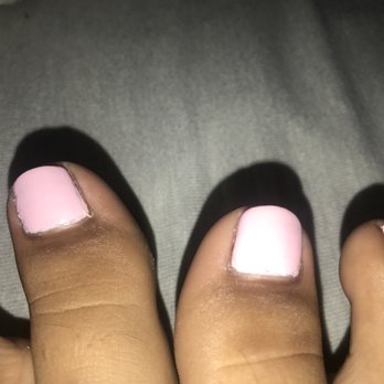 Ooh Lala Nails & Spa - My toes were done by Tony... As you can see they were done poorly and wouldn't recommend him. - Nail Salons Near Me - Clovis, California Ooh Lala Nails & Spa - My toes were done by Tony... As you can see they were done poorly and wouldn't recommend him. - Nail Salons Near Me - Clovis, California