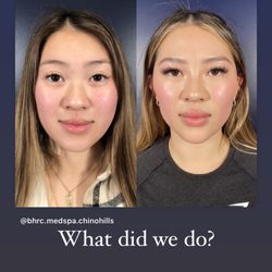 Beverly Hills Rejuvenation Center - Newport Beach