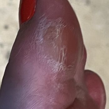 Tulip Nails - This is how they removed my calluses. Totally not ok. I literally just got home and now I have to jump in the shower and remove myself. - Nail Salons Near Me - Thousand Oaks, California Tulip Nails - This is how they removed my calluses. Totally not ok. I literally just got home and now I have to jump in the shower and remove myself. - Nail Salons Near Me - Thousand Oaks, California