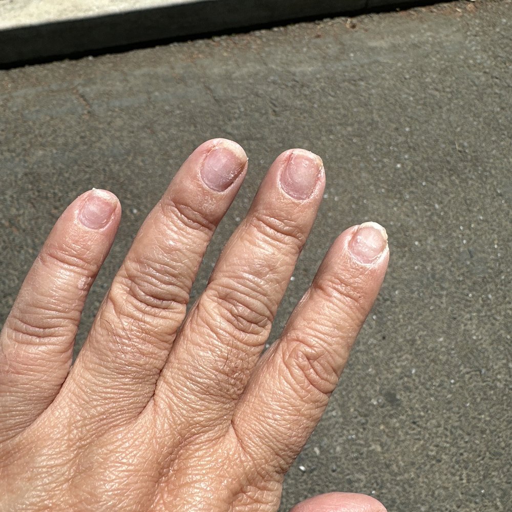 Organic Nails and Spa - Undone acrylic removal - Nail Salons Near Me - Turlock, California Organic Nails and Spa - Undone acrylic removal - Nail Salons Near Me - Turlock, California