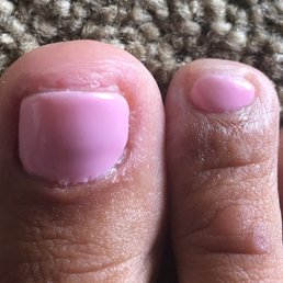My toes are sore after this pedicure. $40 and I feel like I need them redone. Look at the polish line near the cuticle. My toes are sore after this pedicure. $40 and I feel like I need them redone. Look at the polish line near the cuticle.