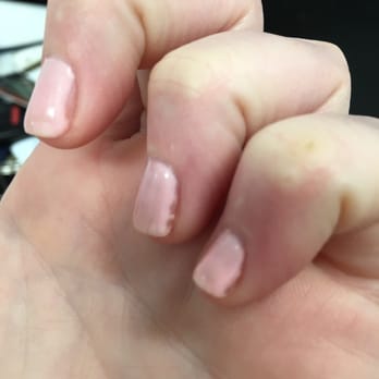 Wonderful Nails - Look at how much of my nail was missed! - Nail Salons Near Me - Hanover, Massachusetts Wonderful Nails - Look at how much of my nail was missed! - Nail Salons Near Me - Hanover, Massachusetts