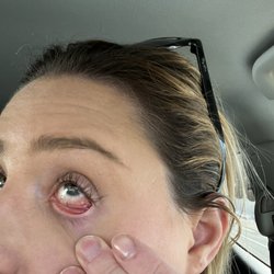 Lila Lash and Beauty - Literal eye infection from the lash glue