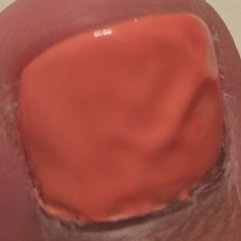 Spa Utopia & Salon - All my nails looked like this, some worse right after the service. - Skin Care Near Me - Vancouver, British Columbia