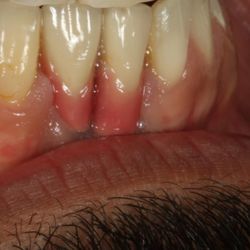 Rubenstein Dental Group