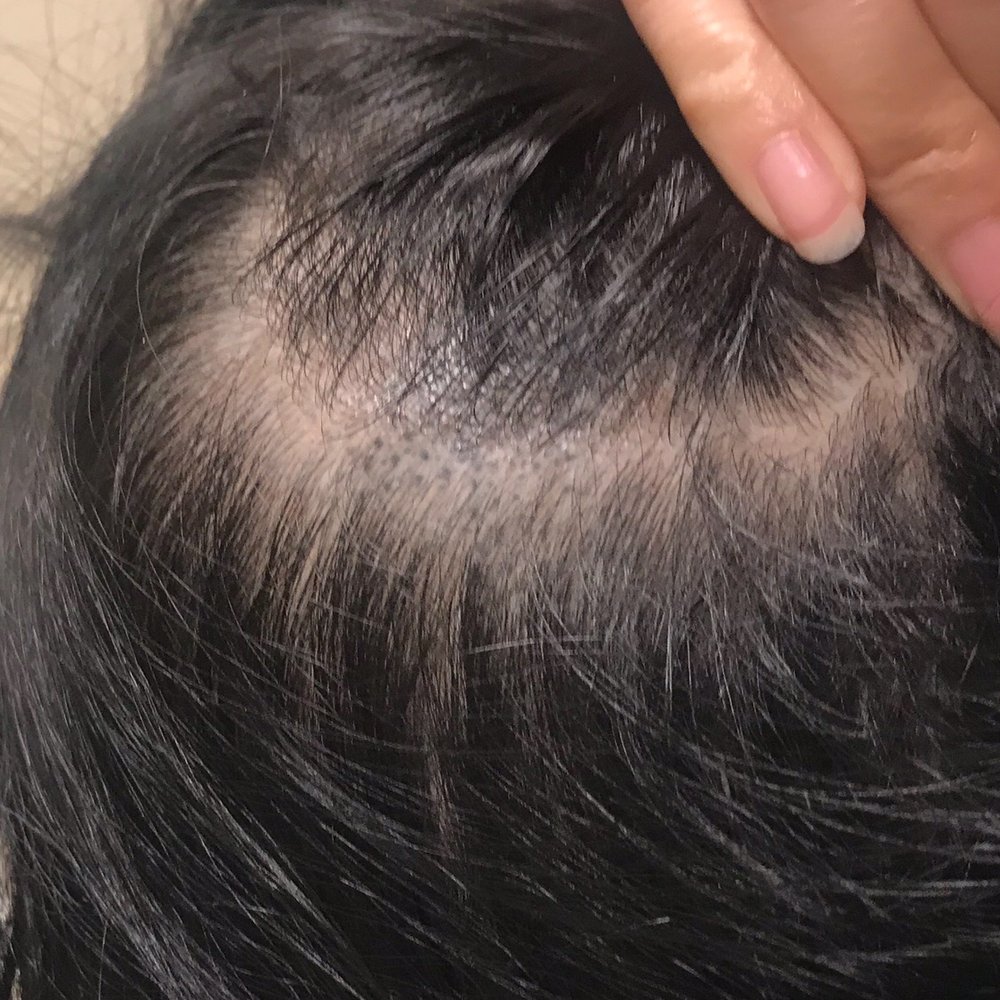 Always Pretty Salon and Spa - Carol is not skilled!!! Please take my advice. After 4 years later and many topical treatment and it's still super dark! - Day Spas Near Me - Coopersburg, Pennsylvania