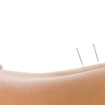 Indigo Wellness Group - Acupuncture Near Me - Stamford, Connecticut Indigo Wellness Group - Acupuncture Near Me - Stamford, Connecticut