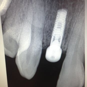 Alta Dental Care - General Dentistry Near Me - Upland, California
