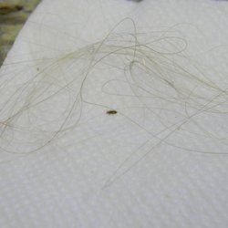 No Lice Twice - Louse and nits