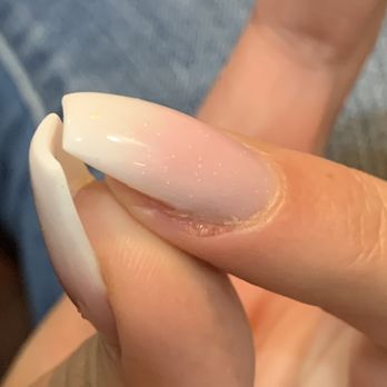 Wonder Nails - Puss and blood along cuticle two days later - Nail Salons Near Me - Seattle, Washington Wonder Nails - Puss and blood along cuticle two days later - Nail Salons Near Me - Seattle, Washington