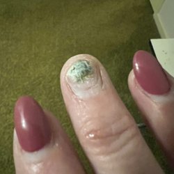 Luxe Nails & Spa - Fungus/mold under "glueing" the nail after it lifted. Horrible.