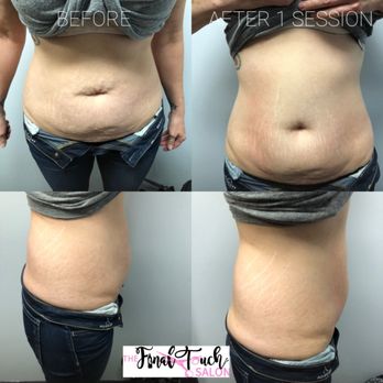 The Final Touch Salon - Cryoskin Toning Treatment - Nail Salons Near Me - Billings, Montana The Final Touch Salon - Cryoskin Toning Treatment - Nail Salons Near Me - Billings, Montana
