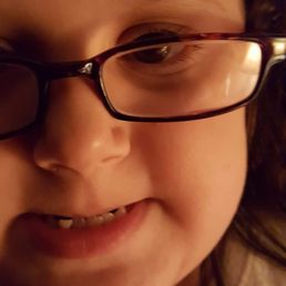 Daughters tooth hanging out. Daughters tooth hanging out.