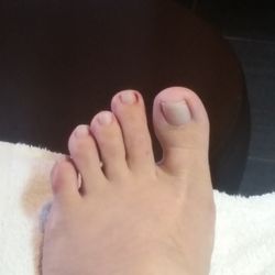 Absolutely Nails Esthetics - This was right after she got it to stop bleeding temporarily. I have a video of it bleeding but I can't upload it.